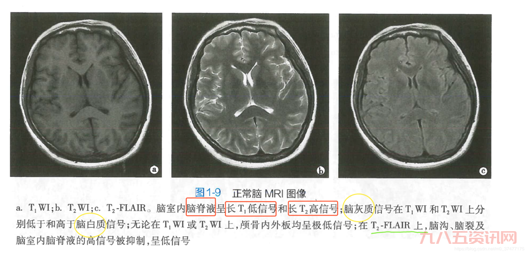 什么是伪t2信号？这篇文章让你秒懂！